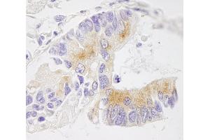 Immunohistochemistry (IHC) image for anti-Echinoderm Microtubule Associated Protein Like 4 (EML4) (AA 150-200) antibody (ABIN7448551) (EML4 抗体  (AA 150-200))