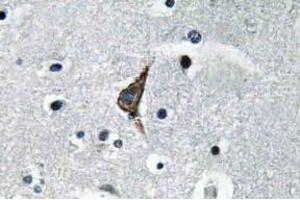 Immunohistochemistry (IHC) analyzes of TLR4 antibody in paraffin-embedded human brain tissue. (TLR4 抗体)