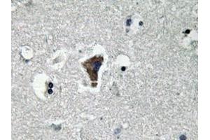 Immunohistochemistry analyzes of MyD88 antibody in paraffin-embedded human brain tissue. (MYD88 抗体)