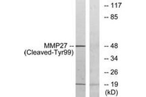 Western blot analysis of extracts from COS7 cells, treated with etoposide 25uM 1h, using MMP27 (Cleaved-Tyr99) Antibody. (MMP27 抗体  (Cleaved-Tyr99))