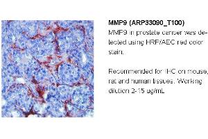Image no. 2 for anti-Matrix Metallopeptidase 9 (Gelatinase B, 92kDa Gelatinase, 92kDa Type IV Collagenase) (MMP9) (N-Term) antibody (ABIN182741) (MMP 9 抗体  (N-Term))