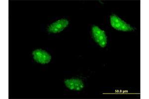 Immunofluorescence of monoclonal antibody to TWIST1 on HeLa cell. (TWIST1 抗体  (AA 100-202))