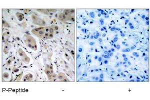 Image no. 1 for anti-V-Akt Murine Thymoma Viral Oncogene Homolog 1 (AKT1) (pSer473) antibody (ABIN196709) (AKT1 抗体  (pSer473))