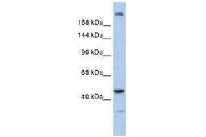 Image no. 1 for anti-Centrosomal Protein 170B (CEP170B) (AA 551-600) antibody (ABIN6743806) (KIAA0284 抗体  (AA 551-600))
