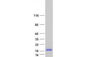 Sterile alpha Motif Domain Containing 13 (SAMD13) (Transcript Variant 1) protein (Myc-DYKDDDDK Tag)