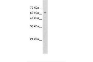 Image no. 2 for anti-Zinc Finger Protein 274 (ZNF274) (AA 87-136) antibody (ABIN203353) (ZNF274 抗体  (AA 87-136))