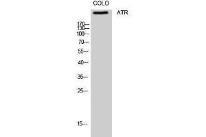 Western Blotting (WB) image for anti-ATR serine/threonine kinase (ATR) (Ser16) antibody (ABIN3183446) (ATR 抗体  (Ser16))