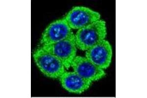 Confocal immunofluorescent analysis of PATL2 Antibody (PATL2 抗体  (Middle Region))