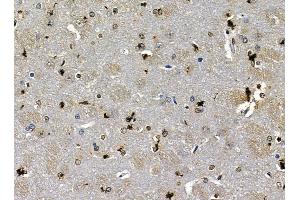 ABIN7095388 and ABIN7099445 at 1/100 staining rat brain tissue by IHC-P. (PREX2 抗体)