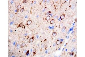 IHC-P: nNOS antibody testing of rat brain tissue (NOS1 抗体  (C-Term))