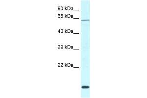 WB Suggested Anti-Dcaf11 Antibody   Titration: 1. (DCAF11 抗体  (C-Term))