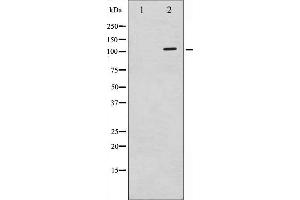 Western blot analysis of c-PLA2 phosphorylation expression in TNF-a treated HeLa whole cell lysates,The lane on the left is treated with the antigen-specific peptide. (PLA2G4A 抗体  (pSer505))