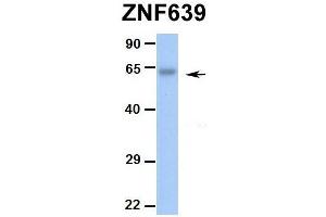 Hum. (ZNF639 抗体  (N-Term))
