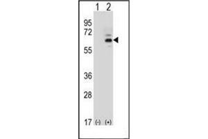 Western blot analysis of FASTK (arrow) using FAST kinase (C-term) Antibody (C-term) Cat.
