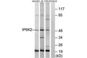 Western blot analysis of extracts from HuvEc/COLO/Jurkat cells, using IP6K2 Antibody. (IP6K2 抗体  (AA 161-210))
