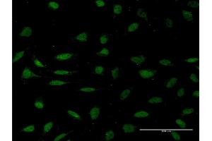 Immunofluorescence of monoclonal antibody to HMGXB4 on HeLa cell. (HMGXB4 抗体  (AA 1-74))