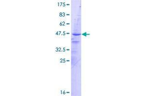 AVPI1 Protein (AA 1-147) (GST tag)