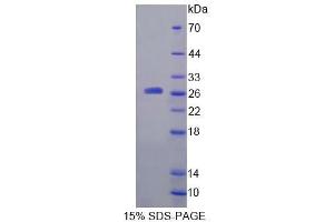 SDS-PAGE analysis of Rat a4GALT Protein.