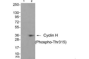Western blot analysis of extracts from JK cells (Lane 2), using Cyclin H (Phospho-Thr315) Antibody. (Cyclin H 抗体  (pThr315))