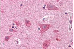 Human Brain, Cortex: Formalin-Fixed, Paraffin-Embedded (FFPE) (BRE 抗体  (AA 9-338))