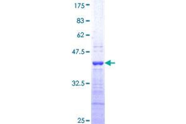 Endothelin 1 Protein (EDN1) (AA 113-212) (GST tag)