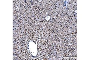 IHC analysis of hnRNP L/HNRNPL using anti-hnRNP L/HNRNPL antibody (ABIN7600130).