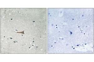 Immunohistochemistry analysis of paraffin-embedded human brain, using DDR1 (Phospho-Tyr513) Antibody. (DDR1 抗体  (pTyr513))