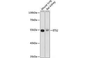 Western blot analysis of extracts of various cell lines using ETS2 Polyclonal Antibody at dilution of 1:1000. (ETS2 抗体)