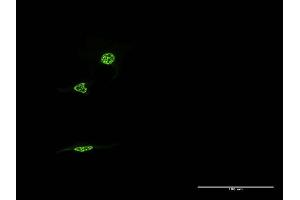 Immunofluorescence of monoclonal antibody to NR1D1 on HeLa cell. (NR1D1 抗体  (AA 233-322))