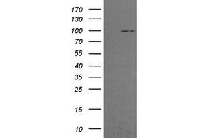 Image no. 2 for anti-Phosphoinositide-3-Kinase, Regulatory Subunit 5 (PIK3R5) antibody (ABIN1500216) (PIK3R5 抗体)