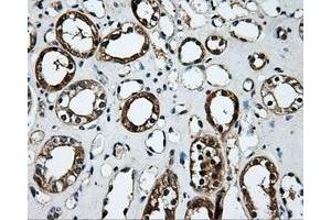 Immunohistochemical staining of paraffin-embedded Kidney tissue using anti-PLEKmouse monoclonal antibody. (Pleckstrin 抗体)
