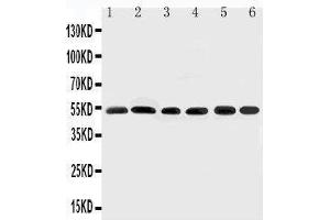 Anti-Smad2 antibody, Western blotting Lane 1: Rat Brain Tissue Lysate Lane 2: HELA Cell Lysate Lane 3: SMMC Cell Lysate Lane 4: JURKAT Cell Lysate Lane 5: U87 Cell Lysate Lane 6: MCF-7 Cell Lysate