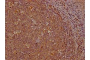 IHC image of ABIN7154410 diluted at 1:200 and staining in paraffin-embedded human tonsil tissue performed on a Leica BondTM system. (GNLY 抗体  (AA 23-145))