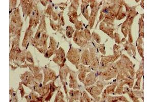 Immunohistochemistry of paraffin-embedded human heart tissue using ABIN7149026 at dilution of 1:100 (ATG4C 抗体  (AA 419-448))