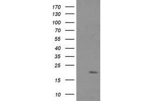 Image no. 2 for anti-Fetal and Adult Testis Expressed 1 (FATE1) antibody (ABIN1498224) (FATE1 抗体)