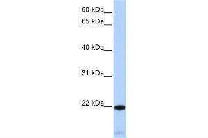 WB Suggested Anti-RGS5 Antibody Titration:  0. (RGS5 抗体  (Middle Region))