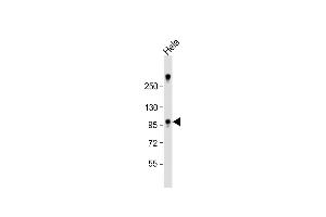 Anti-ZCCHC14 Antibody (Center) at 1:1000 dilution + Hela whole cell lysate Lysates/proteins at 20 μg per lane. (ZCCHC14 抗体  (AA 420-449))