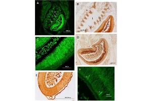 Immunohistochemistry results using Anti-Carbonic Anhydrase II (RABBIT) Antibody. (CA2 抗体)