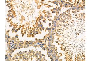 ABIN6259144 and ABIN6274444 at 1/100 staining Rat testis tissue by IHC-P. (PARD3 抗体  (C-Term))