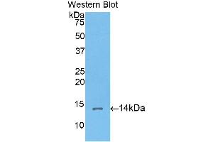 Western Blotting (WB) image for anti-Corin, Serine Peptidase (CORIN) (AA 533-634) antibody (ABIN3203375) (Corin 抗体  (AA 533-634))