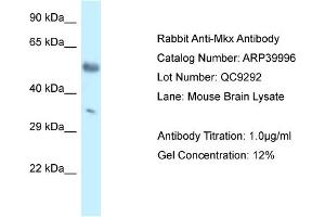 WB Suggested Anti-Mkx Antibody Titration: 1. (MKX 抗体  (C-Term))