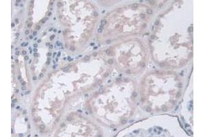 IHC-P analysis of Human Kidney Tissue, with DAB staining. (CPA4 抗体  (AA 55-421))