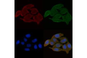 ABIN6259279 and ABIN6275588 staining Hela cells(30 min of UV treatment) by IF/ICC. (SLC24A3 抗体  (Internal Region))