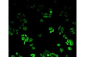 Detection of Hsp27 in Human Hela Cell using Polyclonal Antibody to Heat Shock Protein 27 (Hsp27) (HSP27 抗体  (AA 1-201))