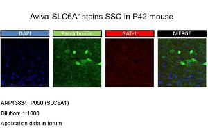 Image no. 2 for anti-GABA Transporter 1 (GAT1) (Middle Region) antibody (ABIN2781581) (SLC6A1 抗体  (Middle Region))