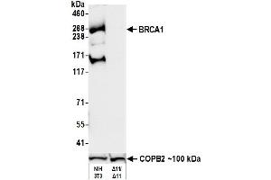 anti-Breast Cancer 1 (BRCA1) (AA 525-575) antibody