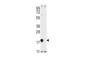 Western blot analysis of anti-THY1 (N-term) Pab (ABIN388803 and ABIN2839126) pre-incubated without(lane 1) and with(lane 2) blocking peptide (BP2050a) in T47D cell line lysate.