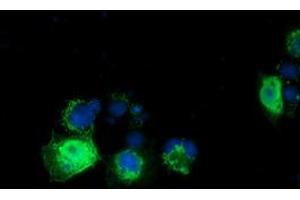 Anti-RASD2 mouse monoclonal antibody (ABIN2453586) immunofluorescent staining of COS7 cells transiently transfected by pCMV6-ENTRY RASD2 (RC201454). (RASD2 抗体)