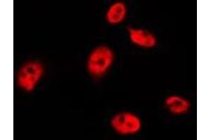 Immunofluorescence (fixed cells) (IF/ICC) image for anti-Tumor Protein P53 (TP53) (pSer315) antibody (ABIN6256267)