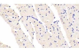 Detection of BACE2 in Mouse Cardiac Muscle Tissue using Polyclonal Antibody to Beta Secretase 2 (BACE2) (BACE2 抗体  (AA 156-407))
